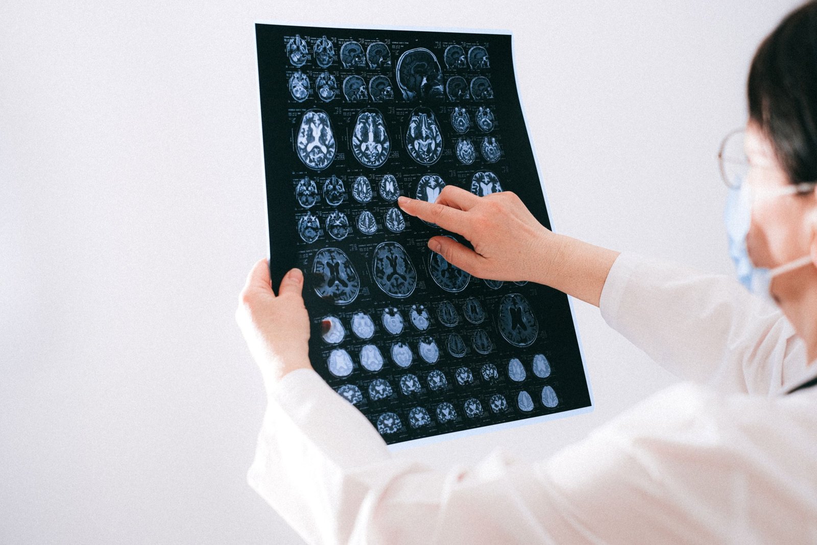 Illustration de l'article « Hypermétabolisme au PET scan »